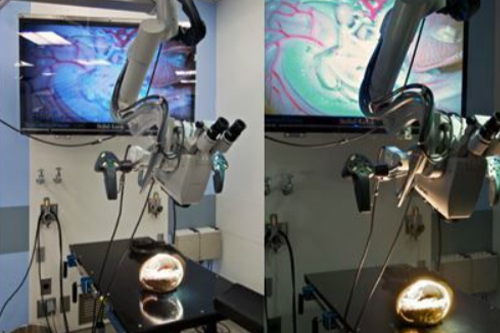 Neurosurgical innovations microscope invention room