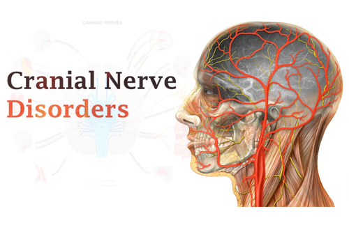 cranial nerve disorders close up img with brain nerves