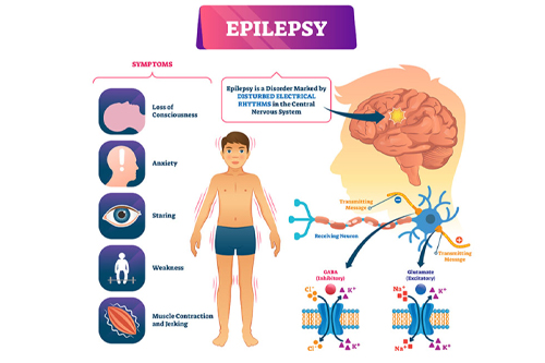 brain disease nerve not get signal in body part nerve shows