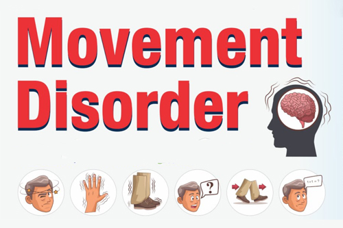 Movement disorders symptoms shows all image