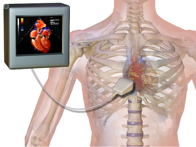 Echocardiography