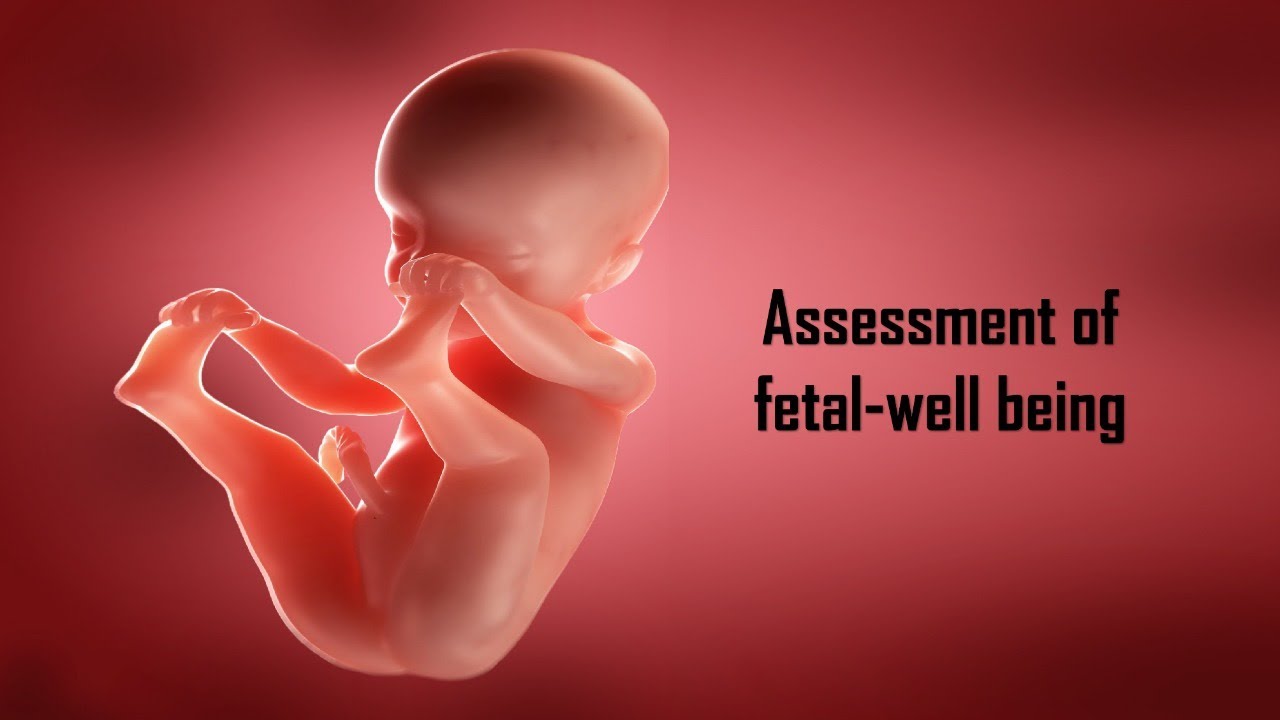 Fetal well-being assessment