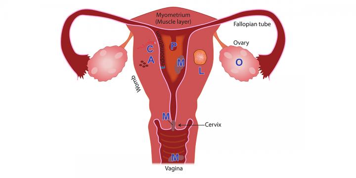 Menstrual disorders