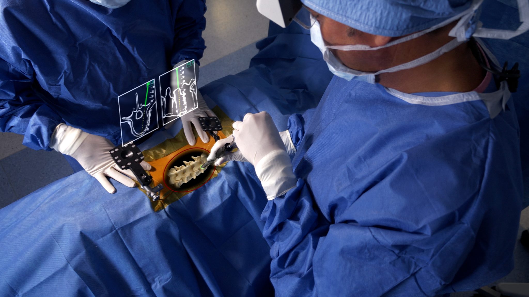 Minimally invasive spine surgery