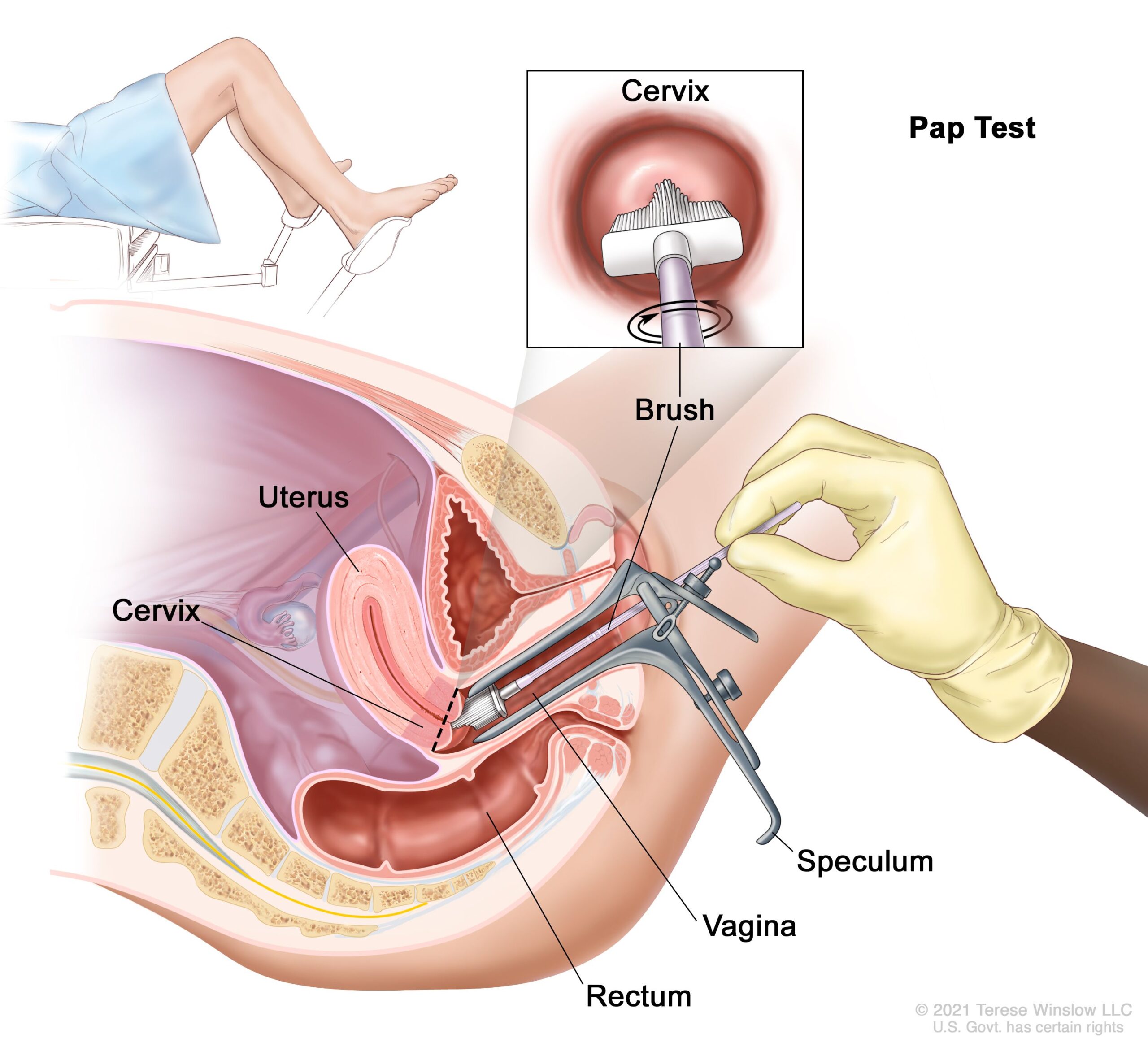 Pap smear