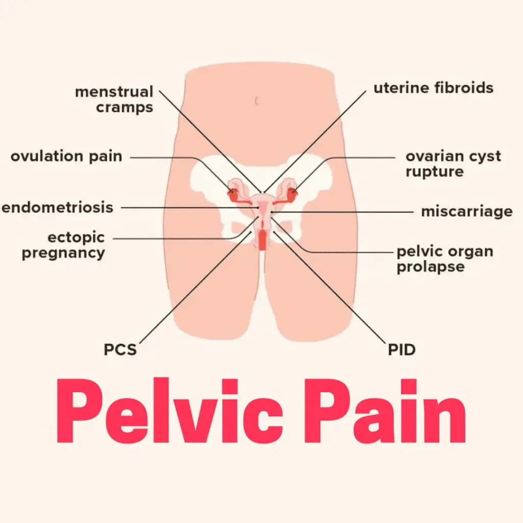 Pelvic pain