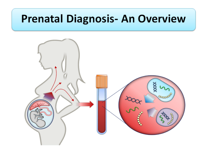 Prenatal-Diagnosis