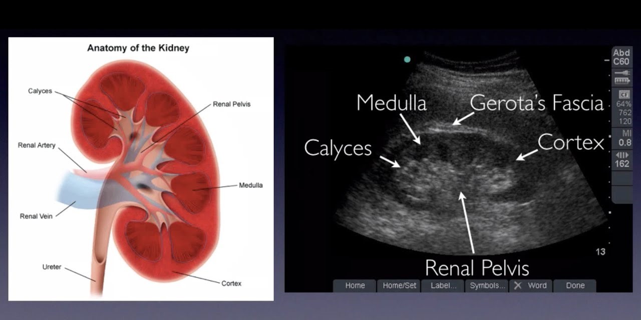 Renal ultrasound